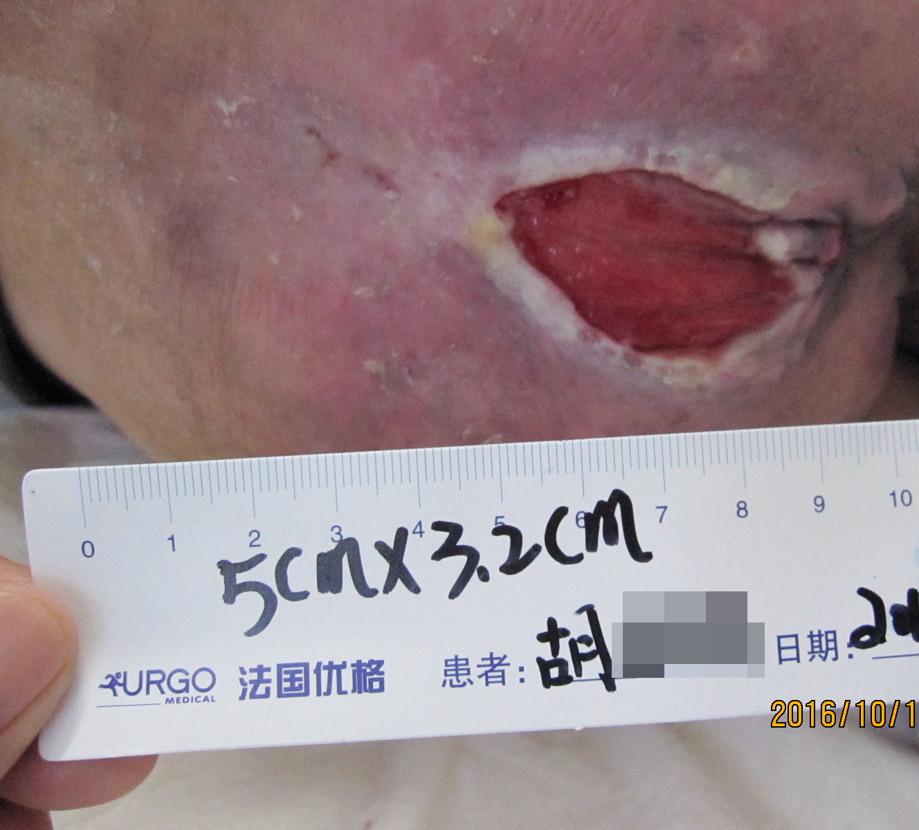 桂林夕阳红养老中心  养生养老  桂林旅游  康复理疗　职工疗养　候鸟旅居　休闲旅游－广西桂林冶金疗养院